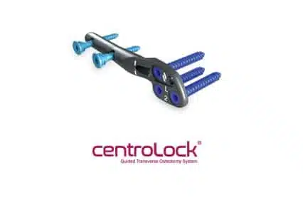 CentroLock